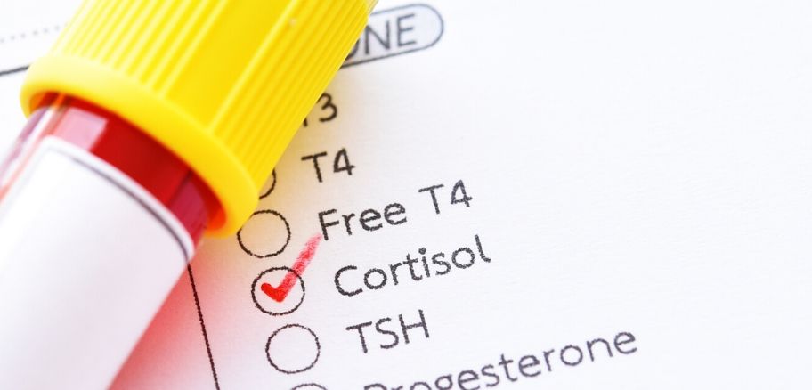 Cortisol | Victory Men's Health